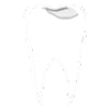 Cavities