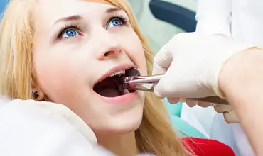 Wisdom Tooth Removal at East Side Dental, Bundaberg