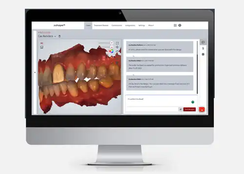 Trios Intraoral Scanner