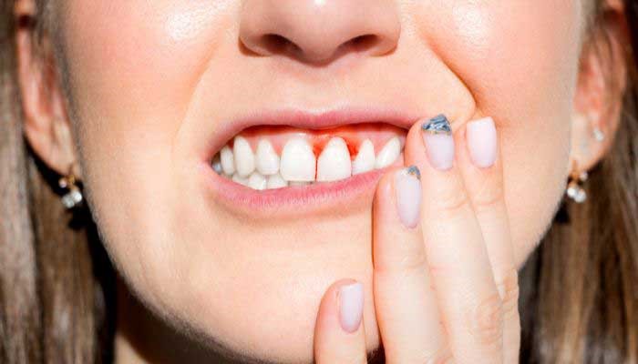 Eastside Dental's Guide to Gum Disease Prevention