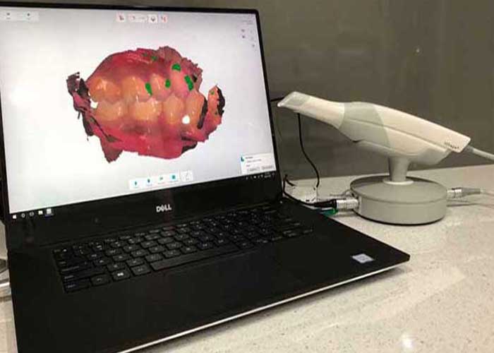 Revolutionizing Dental Impressions with the 3Shape Trios Digital Scanner